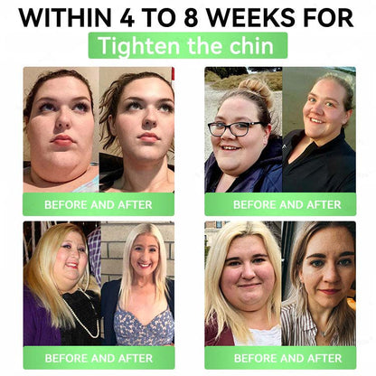 Official Store| 🧑‍⚕️Alcuras® Moringa × Berberine × AMPK 8-Benefit Slimming & Metabolic Nano Microneedle Patch 🇺🇸 Just once a day · Visible changes in 7 days ✅ For obesity, loose skin, diabetes, sleep apnea, joint issues, and more