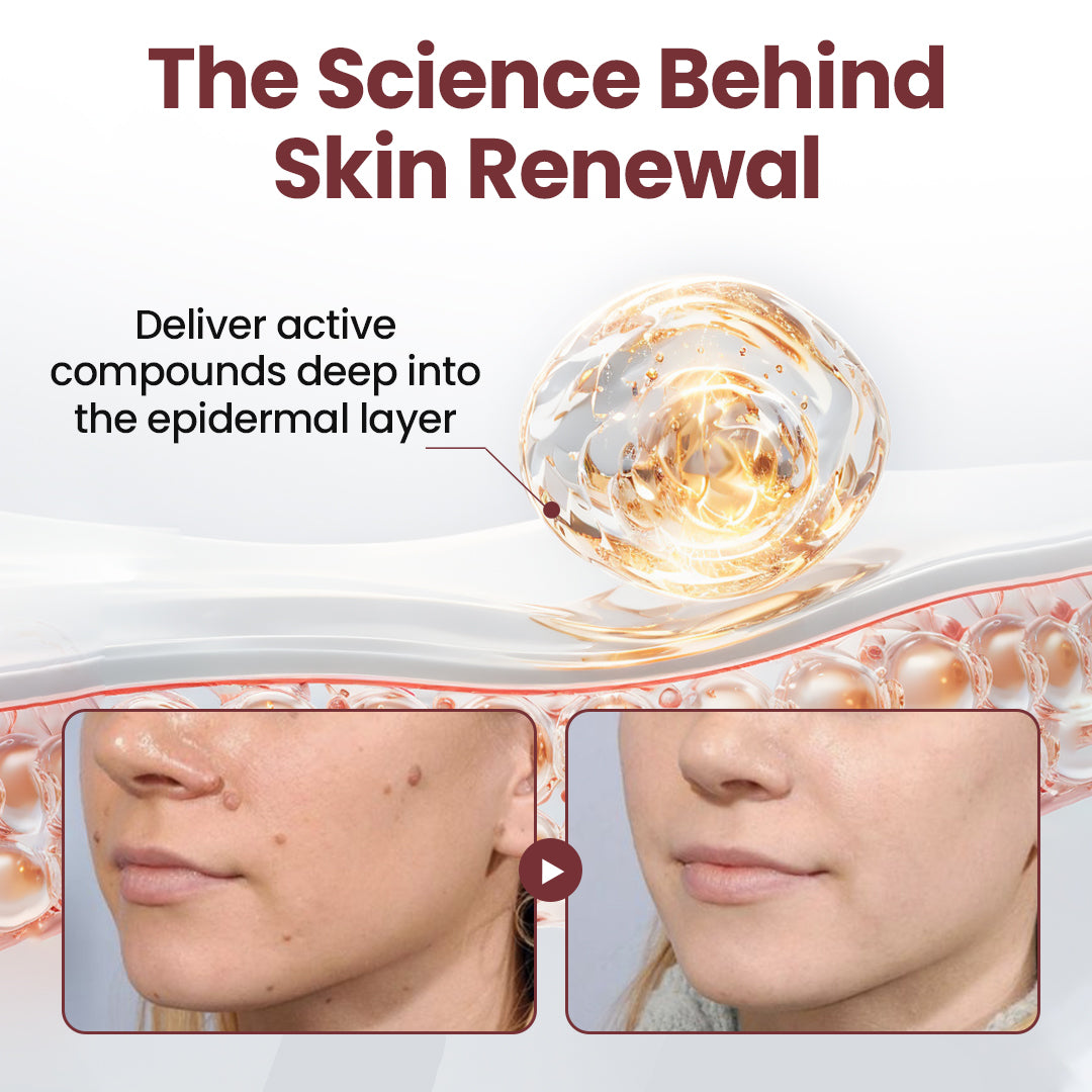 ✅Flash Sale - HEALRIZE® KeraErase Dual-Action Renewal Cream