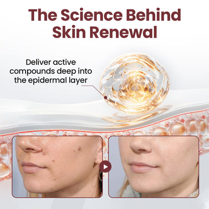 ✅Flash Sale - HEALRIZE® KeraErase Dual-Action Renewal Cream