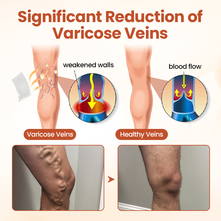 HEALRIZE® VeinTarget Microneedle Patch