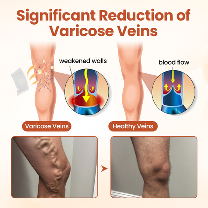 HEALRIZE® VeinTarget Microneedle Patch