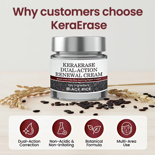 ✅Flash Sale - HEALRIZE® KeraErase Dual-Action Renewal Cream